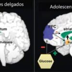 obesidad-infantil-tiene-repercusiones-en-cerebro-y-en-procesos-cognitivos,-senala-especialista