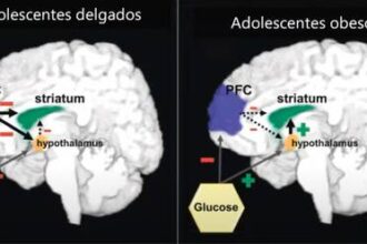 obesidad-infantil-tiene-repercusiones-en-cerebro-y-en-procesos-cognitivos,-senala-especialista