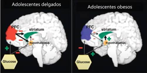 obesidad-infantil-tiene-repercusiones-en-cerebro-y-en-procesos-cognitivos,-senala-especialista